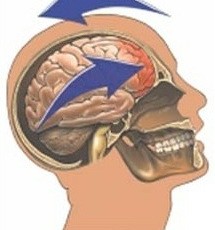 Concussion: "Minor Traumatic Brain Injury"